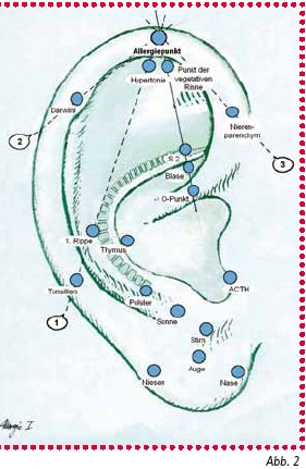 Allergie & Ohrakupunktur