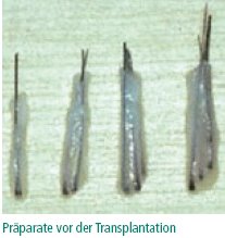 Präparate vor der Transplantation