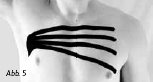 2013-02-Kinesio7