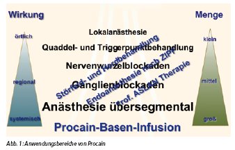 Anwendungsbereiche von Procain