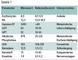 Prostatakarzinom