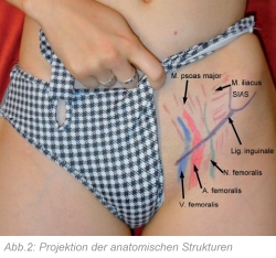 Abb.2: Projektion der anatomischen Strukturen