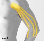 2013-02-Kinesio6