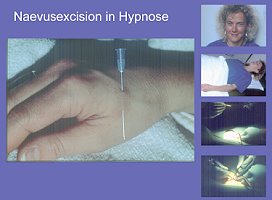 2009-03-Hypnose6